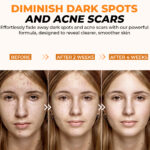 Vitamin C serum - Image 4