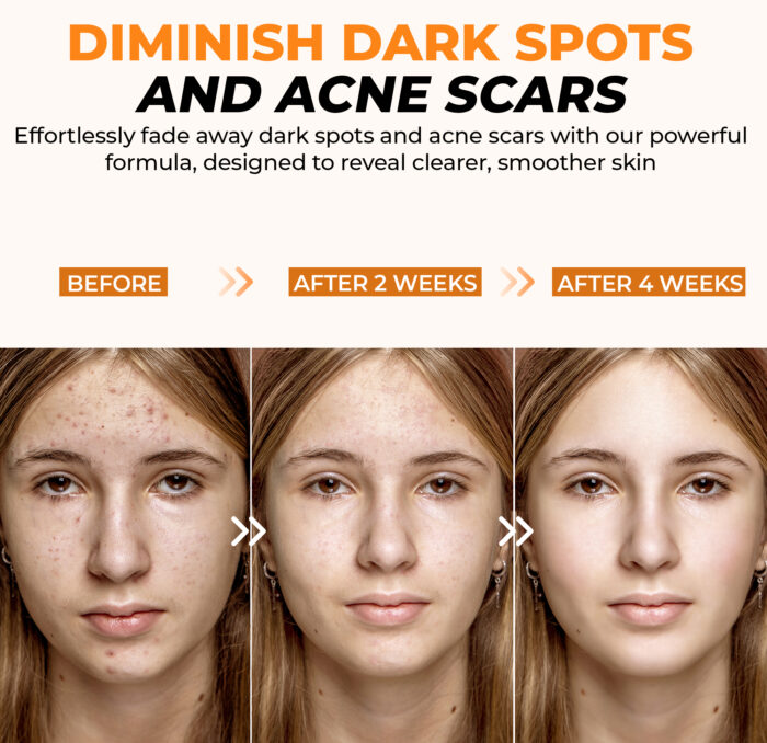 Vitamin C serum - Image 4