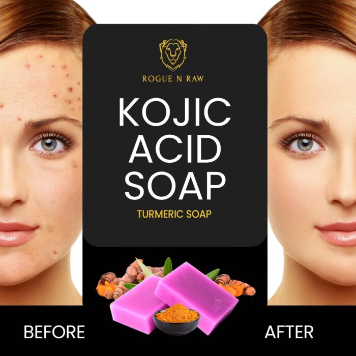 Soap - Image 3
